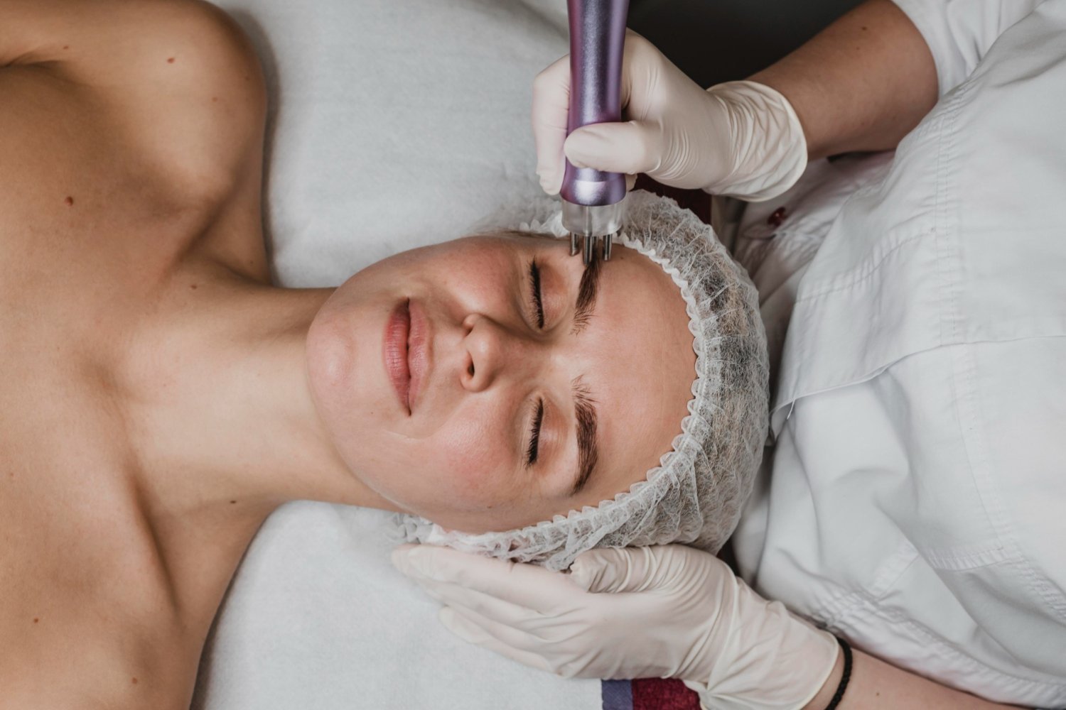 Makeup sponge and mineral powder beside skin recovering from microneedling