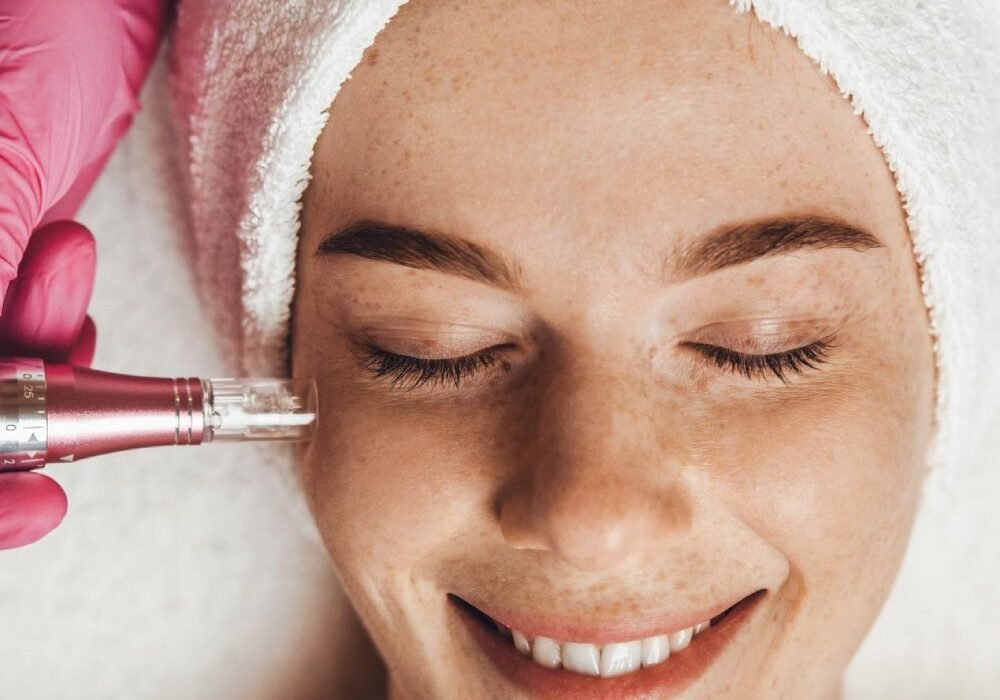 Esthetician applying a hydrating serum to a client’s skin after microneedling